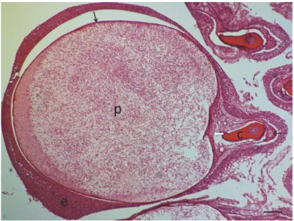 Fig. 7. Henneguya psorospermica plasmodium (p) with spores in the centre and sporogonic stages  at the periphery