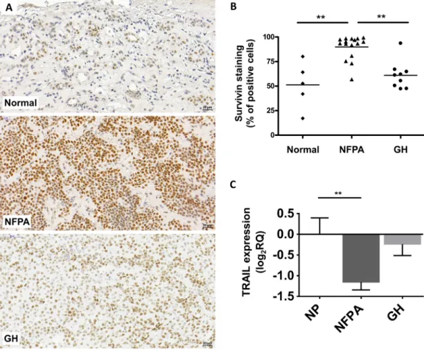 Figure 1: Representative images for survivin immunostaining on pituitary adenomas.  (A) Survivin staining localizes in  cell nuclei