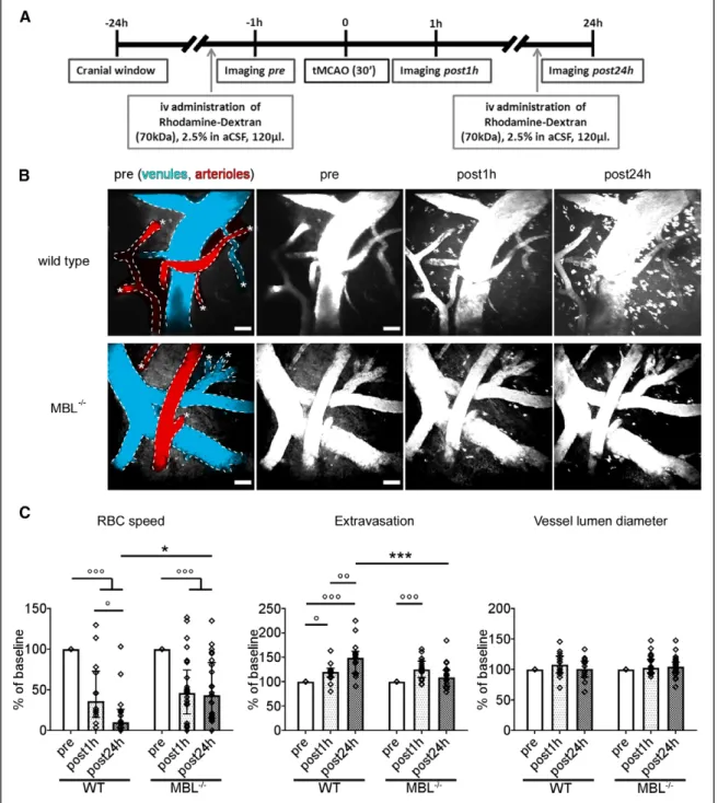 Figure 1. MBL (mannose-binding lectin) deficiency ameliorates impaired hemodynamic responses after ischemia as assessed by in vivo 2-photon micros- micros-copy