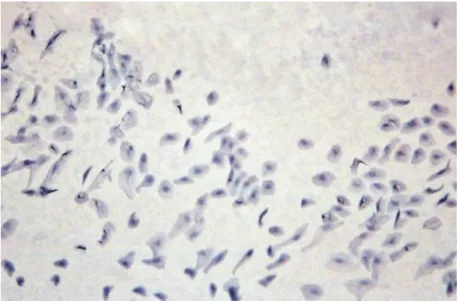 Fig. 3. An impression cytology specimen from the right cornea of patient no. 1, Subgroup I, Group  II after 2 months of treatment