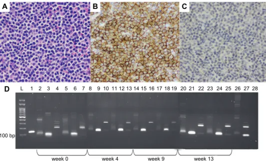 Fig. 2. T-small lymphocytic lymphoma treated with mL-COP.  ( A )  Histopathology presented small  neoplastic T cells with cleaved, basophilic nuclei and scant cytoplasm
