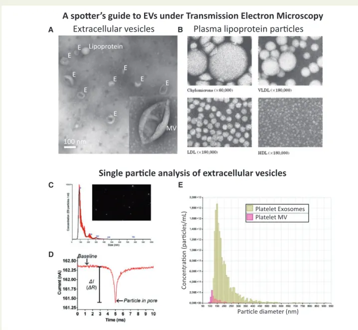 Figure 4 Standard methods of characterizing EVs. (A) Transmission electron microscopy (TEM) of negative-stained EVs reveals the ‘cup-shaped’ appear- appear-ance of exosomes (E) and MVs once they have been dried for TEM (they are spherical in solution)