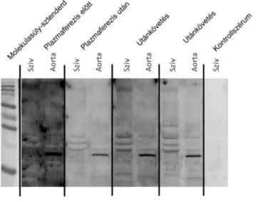 1. ábra Myocardialis protein elleni antitestek (Western blot)