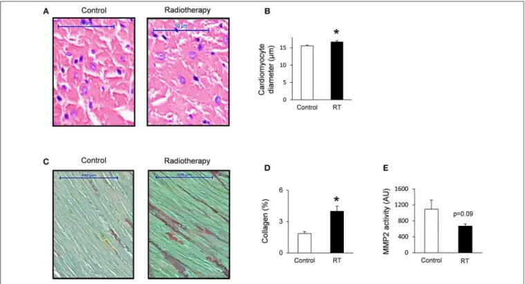 FIGURE 3 | Histology and zymography results at week 19. (A) Hematoxylin-eosin stained slides, (B) cardiomyocyte diameter, (C) picrosirius red and fast green stained slides, (D) cardiac collagen content, and (E) MMP2 activity