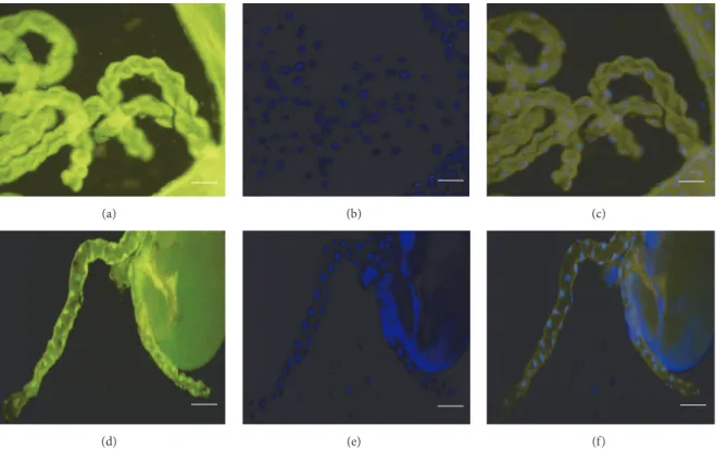 Figure 4: Fluorescence micrographs demonstrating TUNEL-positivity in Malpighian tubules