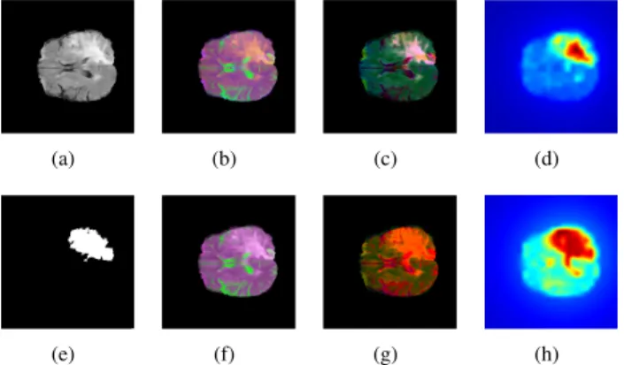 Fig. 1. Comparison of the pseudo-color model for the original ((b)-(d)) and proposed ((f)-(h)) methods on a sample slice (a) from BRATS2015 with (e) whole tumor ground truth