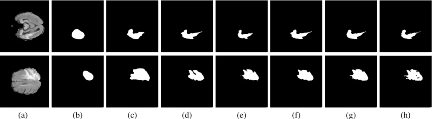 Fig. 4. Segmentation results for different models on MRI image slices (a) from BRATS2015; (b) original method [14]; (c) proposed, saliency-based model;