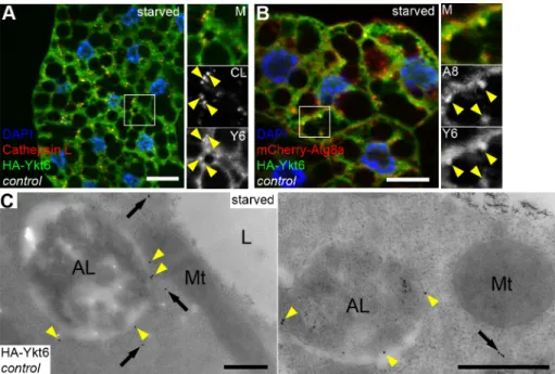 Fig 2. Ykt6 localizes to lysosomes in starved larval fat cells. (A, B) HA-Ykt6 shows obvious colocalization with endogenous Cathepsin-L, a lysosomal hydrolase (A), and also with the 3xmCherry-Atg8a autophagic marker (B).