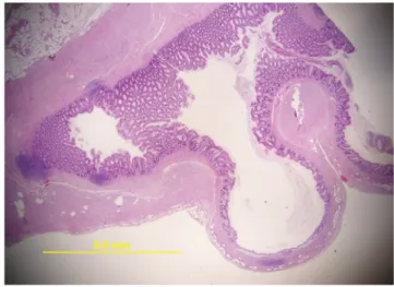 3. ábra A féregnyúlvány mikroszkópos képe hematoxilin-eozin festéssel: 