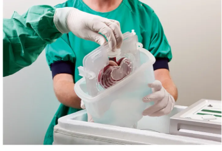 1. ábra Hipotermiás gépi veseperfúzió, a vese kiemelése a gépből   (Kidney Assist®, Organ Assist, Groningen, Hollandia; a cég  en-gedélyével)