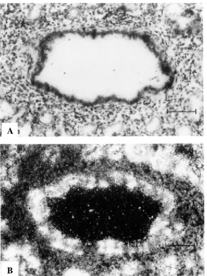 Figure 14. SP-A mRNA in scattered bronchiolar epithelial cells of a 22-week fetus.  