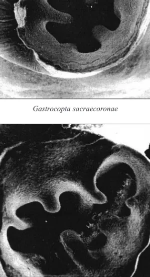 Fig. 3: Aperture of Gastrocopta species on SEM photo shooting (number and location of teeth are the  characteristic of species) Gastrocopta serotina Ložek (100 x); Gastrocopta sacraecoronae Krolopp (100 x).