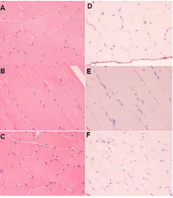 Figure 7. Muscle biopsy sections taken from the exercise group. Left panel (A, B, and C)  shows sections taken from a Vastus Lateralis muscle biopsy and stained with  hematoxylin-eosin