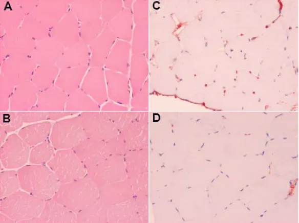 Figure 8. Muscle biopsy sections taken from the control group. Left panel (A and B)  shows cross sections taken from a Vastus Lateralis muscle biopsy and stained  with hematoxylin-eosin