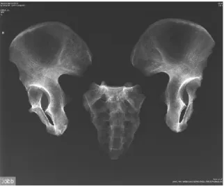 3. ábra. A medence röntgenfelvétele történeti embertani anyagon. A felvétel elkészítésénél  figyelni kell, hogy az ízületek ne érintkezzenek egymással