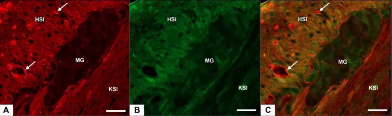 15. ábra  Reprezentatív  fluoreszcens  mikroszkópos  felvétel myentericus ganglionról (MG)  kontroll patkány  ileumából készített paraffinba ágyazott metszeten MMP9-TIMP1 kettős jelöléses immunhisztokémiai festés  után