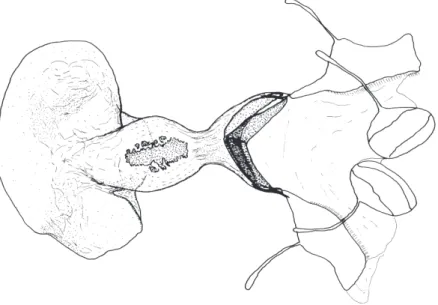 Fig. 68. Lophoterges (Tibeterges) hoenei D RAUDT , holotype female, Tibet, Batang