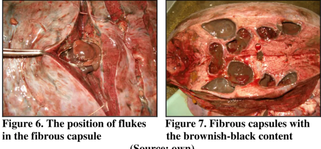 Figure 6. The position of flukes       Figure 7. Fibrous capsules with       in the fibrous capsule                        the brownish-black content 