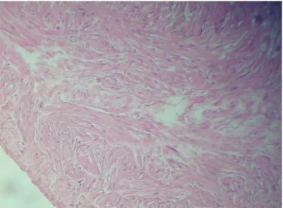 25. ábra: A mezei nyúl méhében megfigyelt daganat szövettani képe. Hematoxilin-eozin festés 