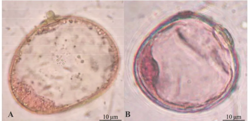 3. ábra Kései egymagvas fejlődési stádiumú kukorica (A) és búza (B)  mikrospóra. 