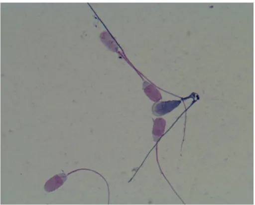 4. ábra: Fent él ő  ép akroszoma nélküli spermium, középen holt fellazult  akroszómájú spermium, és él ő  ép akroszómájú spermiumok (1000x  nagyítás) 