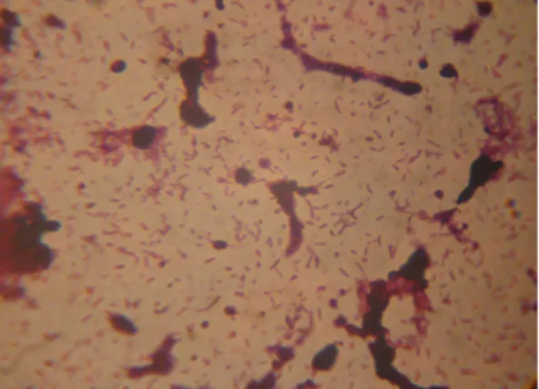 5. ábra A Clostridium sordellii baktérium fénymikroszkópos felvétele  Forrás: saját felvétel 