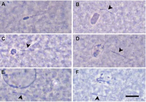 Fig 5. Fertilization of porcine oocyte: male pronucleus formation. A: