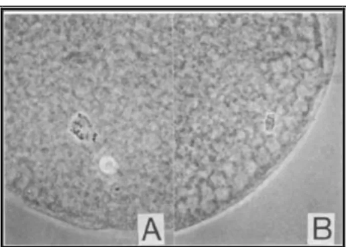 7. kép: Kalcium−ionoforral aktivált petesejtek: normális (A), abnormális (B)  orsóval