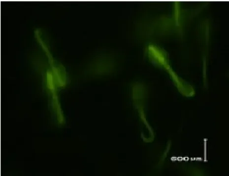 9. kép: Ép membránnal rendelkező sejtek  10. kép: Kapacitációszerű változáson                                                                                                  átesett sejtek 