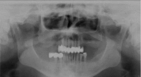 3. ábra A szakértői vizsgálat idején készült röntgenfelvétel 