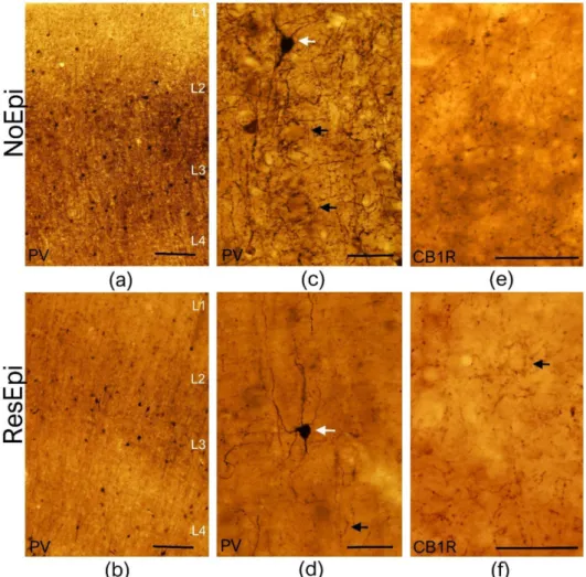 Figure 1. Light microscopy of the human temporal neocortex. Low magnification light microscopic images show the distribution of PV-positive elements in the human temporal neocortex derived from NoEpi (a) and ResEpi (b) slices