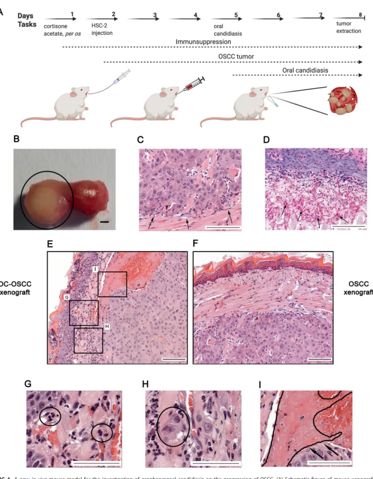 FIG 4 A new in vivo mouse model for the investigation of oropharyngeal candidiasis on the progression of OSCC
