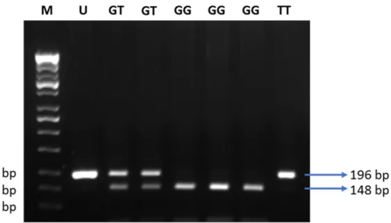 Figure 4. Electrophoresis of the digested products by MvaI. M: DNA marker 100 bp; U: uncut PCR product (196 bp); GG: 