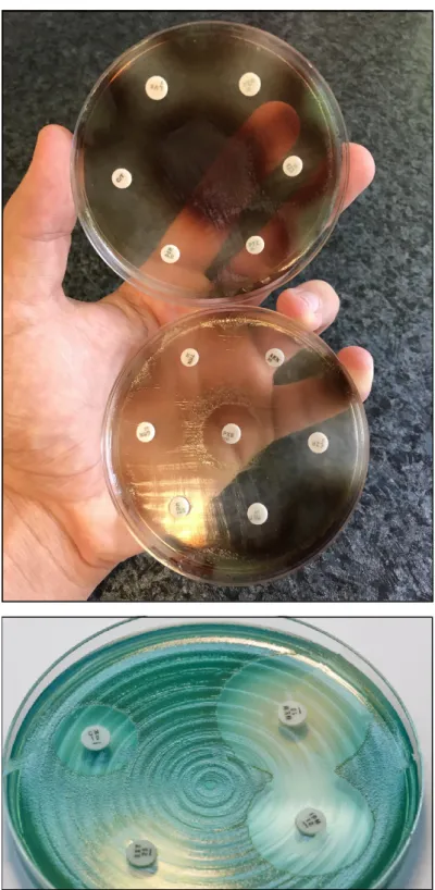 Figure 1. P. aeruginosa antimicrobial susceptibility testing using disk diffusion on Mueller-Hinton  agar plates