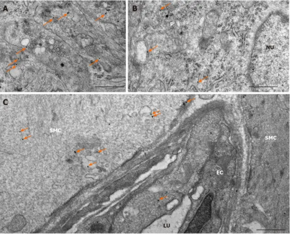 Figure 3 Representative electron micrographs subjected to matrix metalloproteinase 9 post-embedding immunohistochemistry 