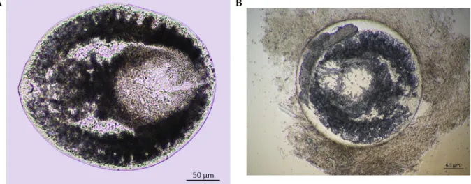 Fig. 4. A/B: Micrographs of encysted prohemistomulum metacercaria type (Cyathocotylidae) from the musculature of common carp (Cyprinus carpio) collected from Northeastern farm.