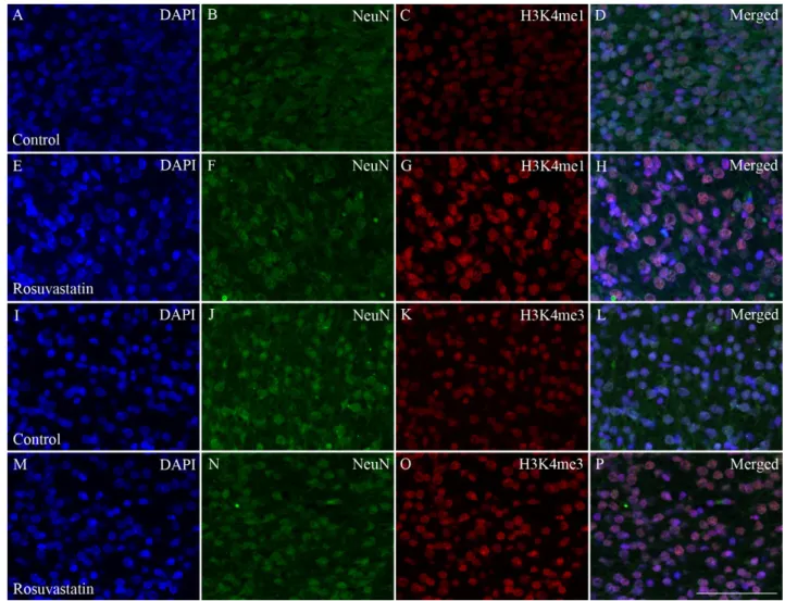 Figure 7. Colocalization of H3K4 methylation patterns and NeuN immunoreactivity in neurons of the newborn brain