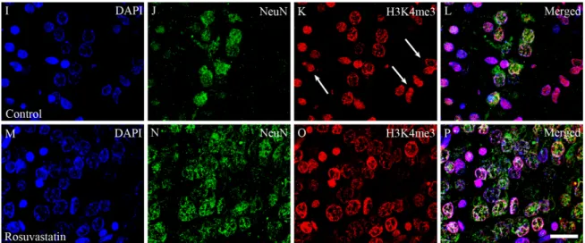 Figure 8. Laser confocal microscopy images of H3K4me1 and H3K4me3 immunoreactivities in neuronal nuclei