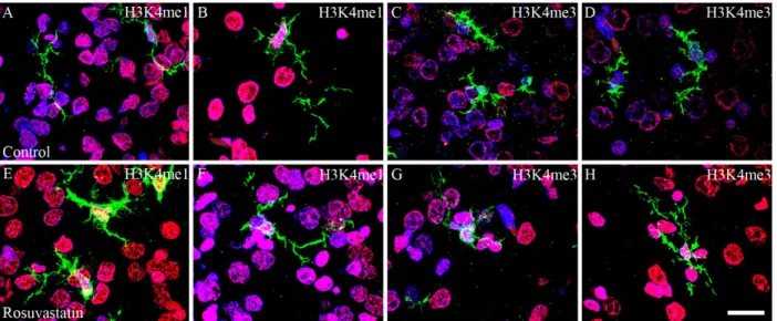 Figure 9. Colocalization of H3K4 methylation patterns and Iba1 immunoreactivity in the microglial cells of the newborn  brain