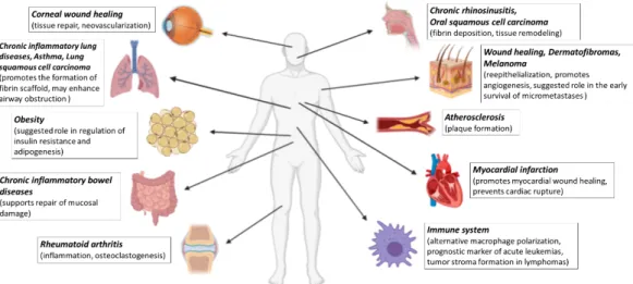 Figure 1. Summary overview of diseases discussed in this review in which FXIII-A may play a  role
