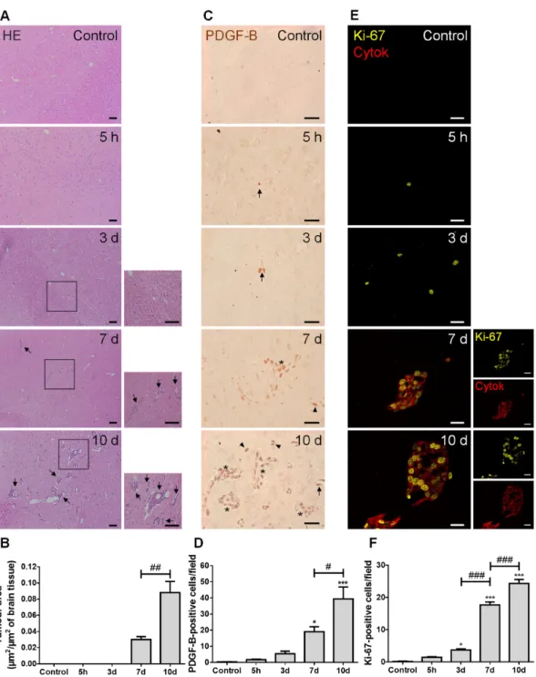Figure 1. Injection of triple negative (TN) breast cancer cells (BCCs) leads to a time-dependent formation of metastases  with PDGF-B and Ki-67-positive cells