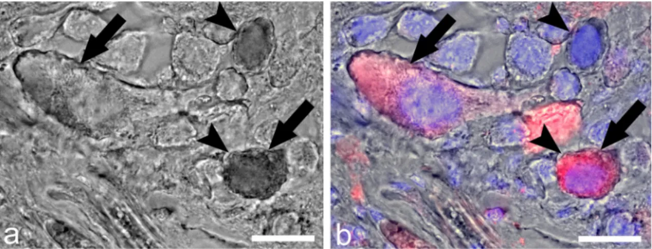 Figure 4.  Double-labeling of ly-GnRH/CRZ neurons in the anterior lobe of the right cerebral ganglion by  IHC and nickel-lysine backfill
