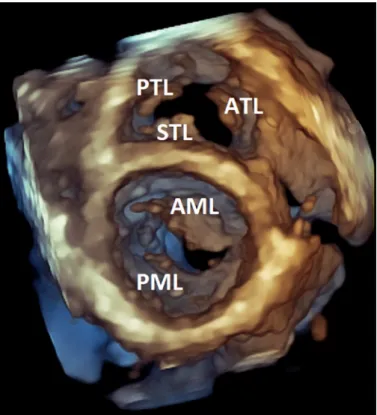 Figure 1. Representative volume-rendered three-dimensional (3-D) trans- trans-thoracic echocardiographic image of an athlete ’ s heart (diastolic frame).