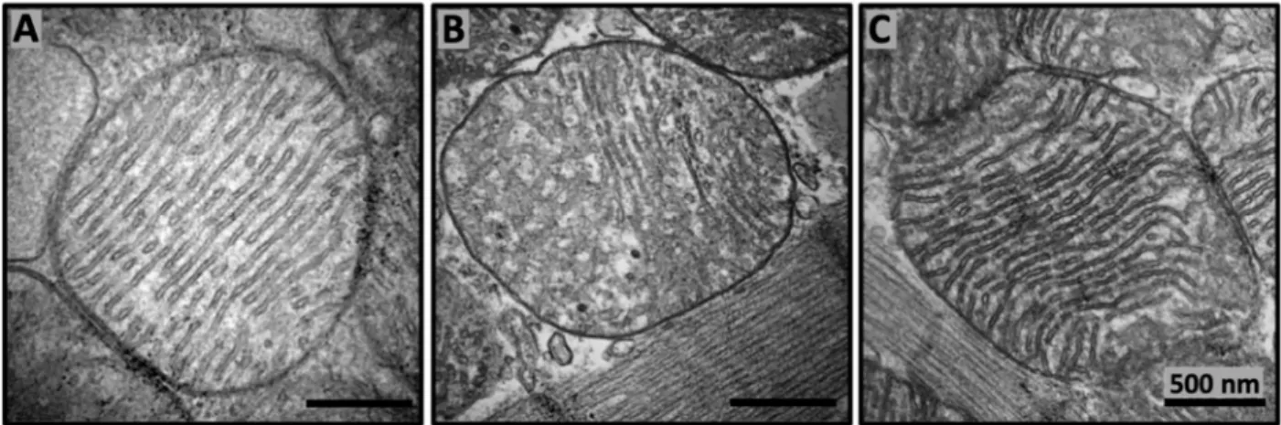 Figure 2. SS-31 repairs mitochondrial cristae architecture in aged mice. Representative transmission electron micrography  images of murine cardiac mitochondria from 6 months old (A), 26 months old (B), and 26 months old treated with SS-31  (C)