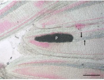 Fig. 2. Gill filaments of a pumpkinseed collected in Hungary. Close to the tip of  the  filament  a  Myxobolus  dechtiari  plasmodium  (P)  in  continuation  of  the  cartilaginous gill ray (arrows) is located