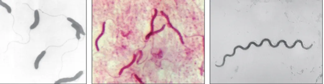 2.4. ábra. Spirális alakú baktériumok: Vibrio cholerae, Spirillum volutans,  Treponema pallidum
