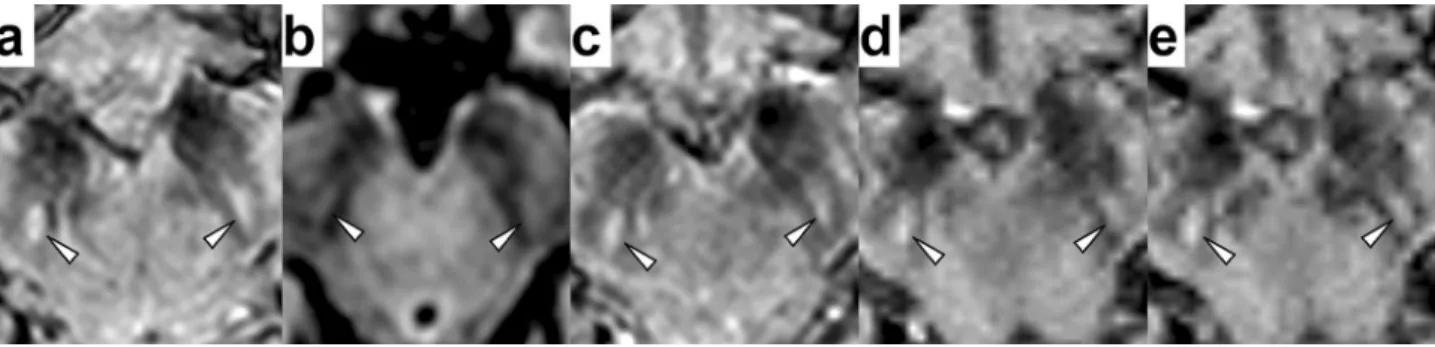 Figure 1.  True-negative interpretation of the images of a 63-year-old healthy female subject