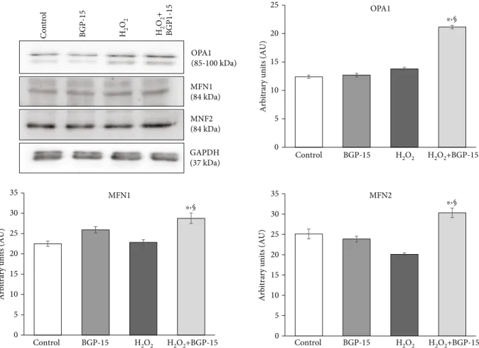 Figure 9: Eﬀect of BGP-15 treatment on mitochondrial fusion proteins in NRCM cells. Western blot analysis of OPA1, MFN1, and MFN2 as well as densitometric evaluation is shown