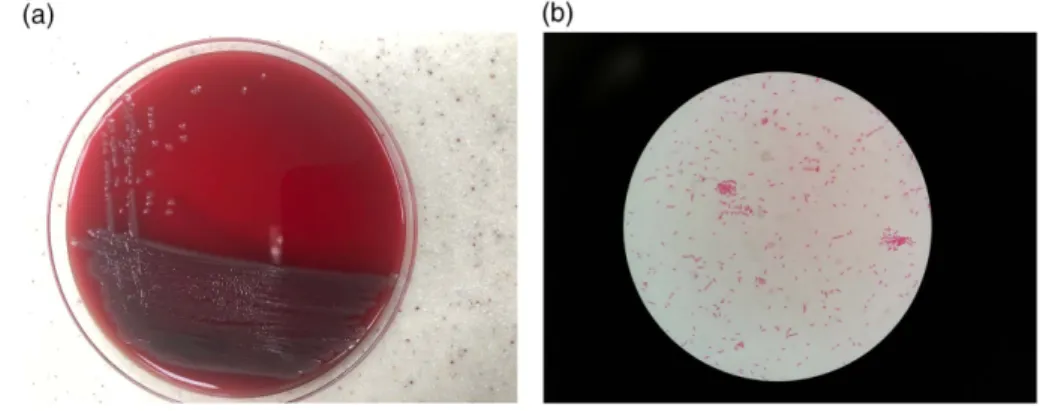 Figure 1. (a) The macroscopic appearance of W. virosa on blood agar after 24-h incubation
