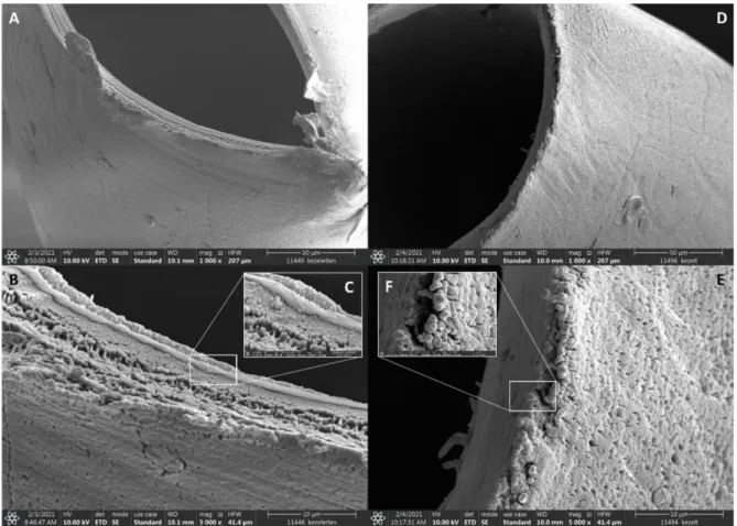 Figure 4. Scanning electron microscope images of the untreated polysulfone membrane (A–C, negative control) and after anti-EpCAM immobilization (D–F).